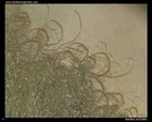 Bacillus mycoides